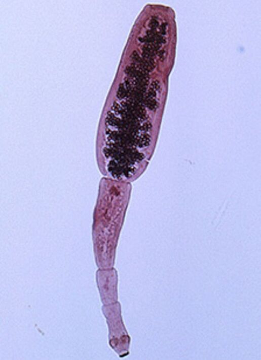 Echinococcus din corpul uman
