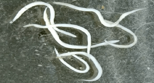 oxiuri în corpul uman