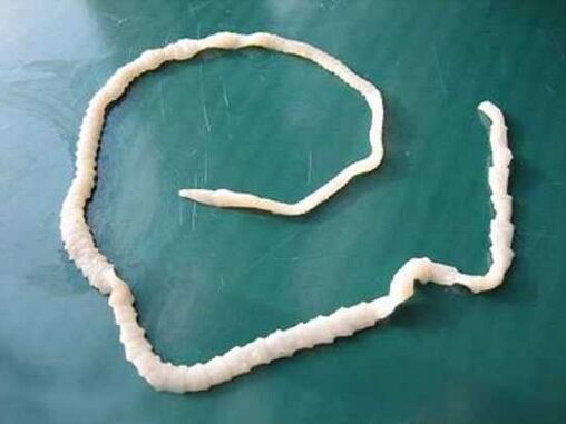 tenia umană de porc