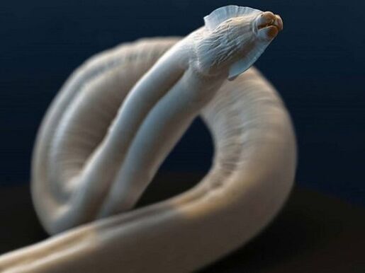 toxocara din corpul uman