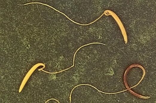 vierme din corpul uman