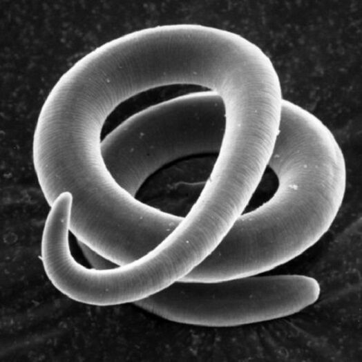 vierme parazit trichinella la om