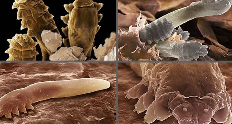 tipuri de paraziți cutanați umani