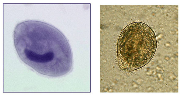 Balantidia ciliate, parazită în intestinul gros
