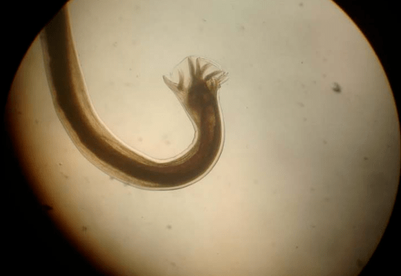 Parazit la microscop